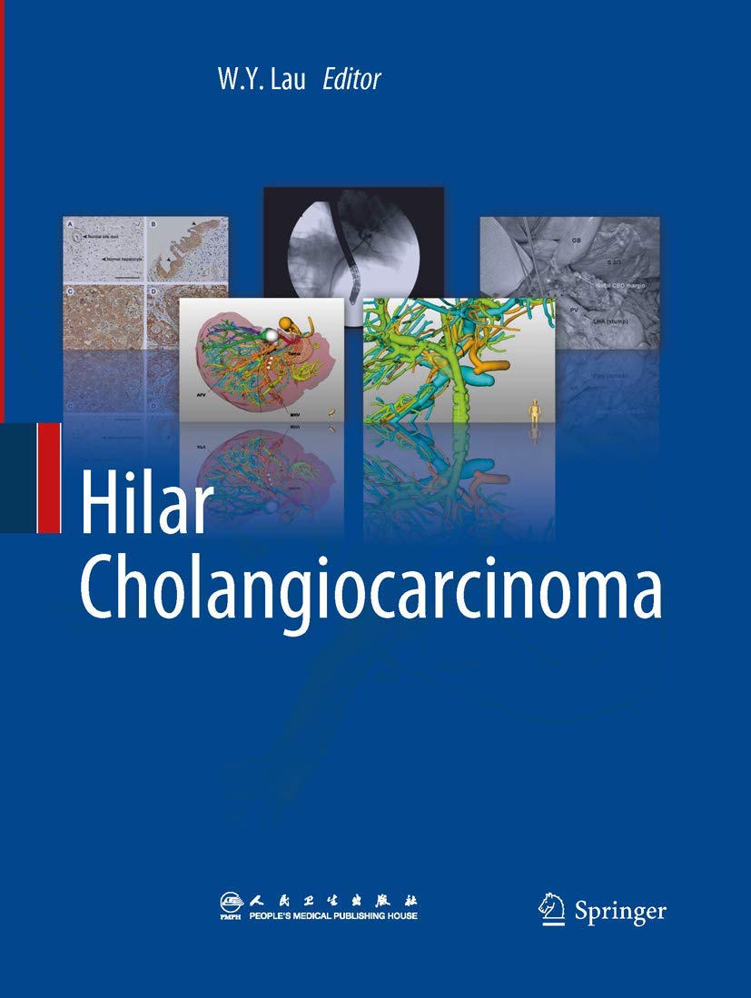Hilar Cholangiocarcinoma cover
