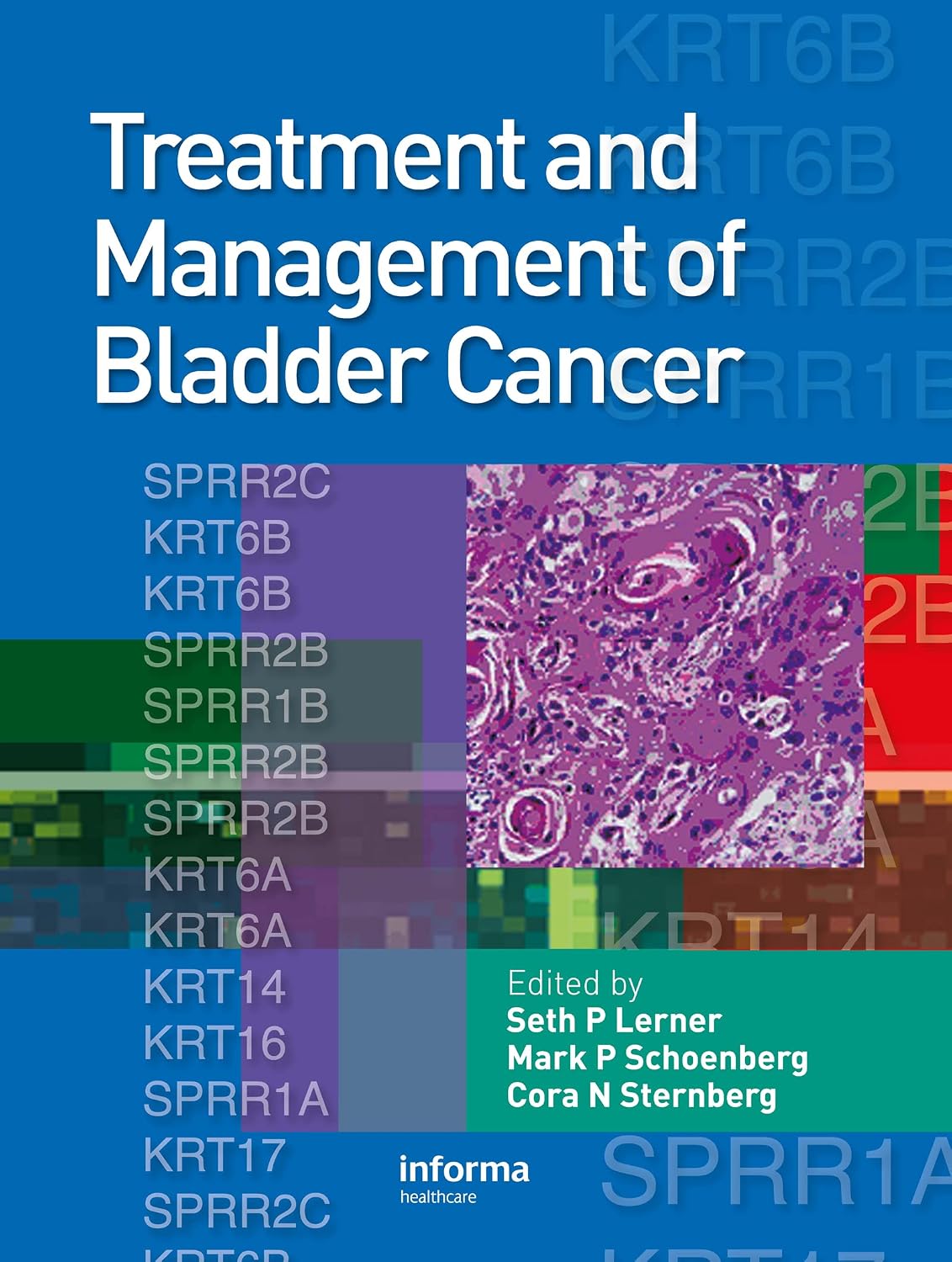 Treatment and management of bladder cancer cover