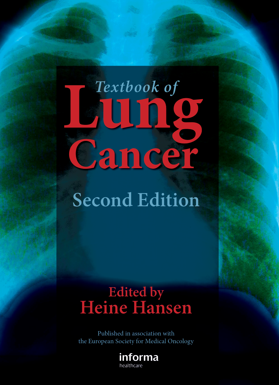 Textbook of Lung Cancer cover