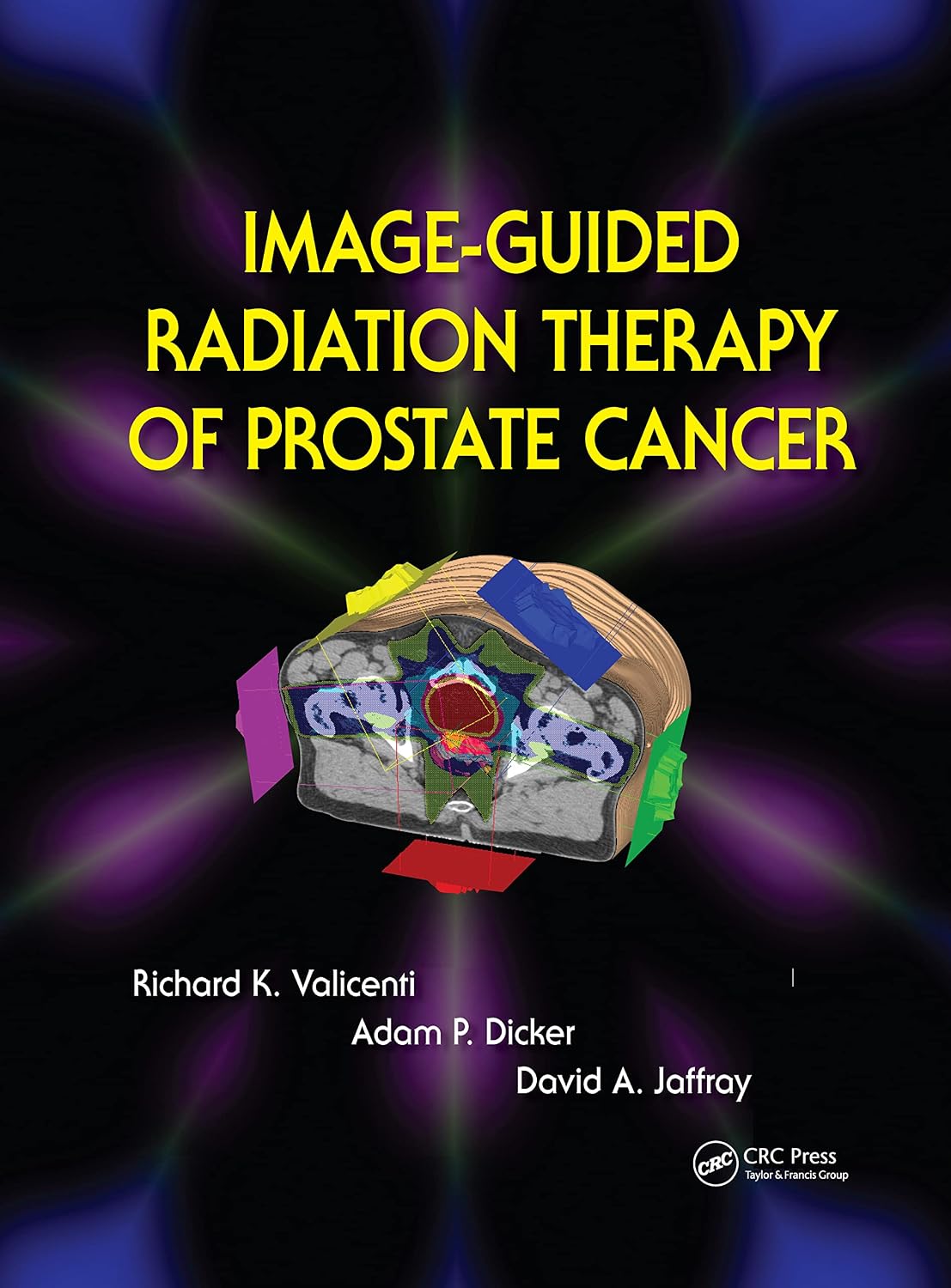 Image-Guided Radiation Therapy of Prostate Cancer cover