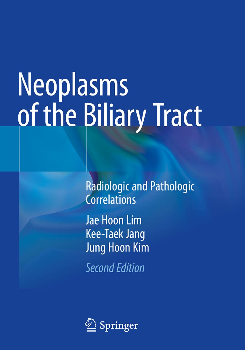 Neoplasms of the Biliary Tract cover