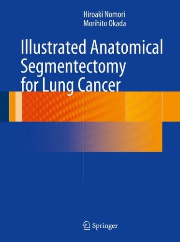 Illustrated Anatomical Segmentectomy for Lung Cancer cover